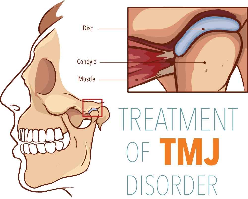 TMJ Treatment Dentist In Provo UT